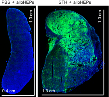 Science Advances：Transforming the spleen into a liver-like organ in vivo在体内将脾脏转化为肝样器官